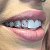 стразы на зубы отбеливание зубов
