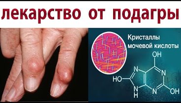 Все Врачи пьют этот чай. Снижает уровень мочевой кислоты и лечит подагру