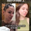 Фотография "Очищение организма 👍👍👍
Прыщи ❌аллергия❌ дерматит ❌псориаз ❌кожный зуд ❌высыпания❓ лишний вес
🙌🙌🙌Детокс -
это самый щадящий способ очистки организма от токсинов"