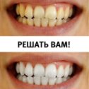 Фотография от White Smile Анапа