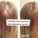 Фотография "Выпадают волосы? 
Результаты уже после одного курса применения сыворотки. 
Для получения подробной информации переходите по любой ссылке в комментариях "