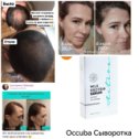 Фотография "Сыворотка для роста и против выпадения волос Active Serum. Производство Германия."