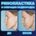 Фотография от КатеринаКудинова ПластическийХирург