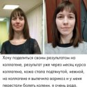 Фотография "💚Хочешь блестящие волосы❓
💚Кожу без морщин❓
💚Крепкие ногти❓
💚Не хрустящие 😁суставы❓
Тебе нужен ОН
Наш новый КОЛЛАГЕН ‼️‼️‼️"