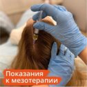 Фотография "Процедура требуется для улучшения сосудистого тонуса кожи головы. Есть необходимость в укреплении луковиц. Важно замедлить и полностью остановить нетипичный «волосопад». Требуется активизация роста и пробуждение новых волос. Нужно питание и/или увлажнение кожному слою полезными веществами и витаминами.

Смесь мезококтейлей для инъекций подбирается индивидуально для каждого пациента. Это позволяет быстро устранить проблемы, вызванные внутренними и внешними факторами.
Записаться на консультацию трихолога вы можете по телефону медицинского центра: 34-50-59
Терешковой 18, АМД ЛАБОРАТОРИИ КЕМЕРОВО
#трихолог #трихология #лечениеволос #лечениесебореи #полимурамил #трихоскопия #трихологкемерово"