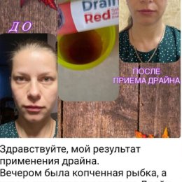 Фотография "Драйн снимает отечность и запускает процесс похудения!!!"