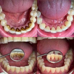 Фотография от Алексей Dentist Богородицкий 🦷