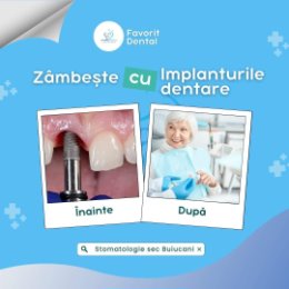 Фотография от Clinica Favorit Dental  Buiucani