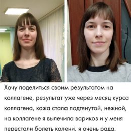 Фотография "💚Хочешь блестящие волосы❓
💚Кожу без морщин❓
💚Крепкие ногти❓
💚Не хрустящие 😁суставы❓
Тебе нужен ОН
Наш новый КОЛЛАГЕН ‼️‼️‼️"