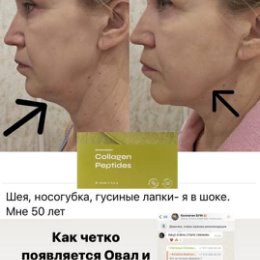 Фотография "Узнать подробнее можно по ссылке в комментариях 👇 👇 👇 "