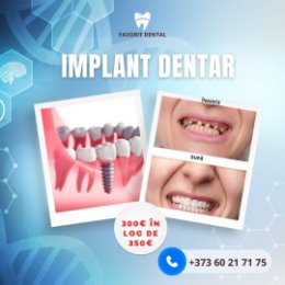 Фотография от Favorit Dental Chișinău 060217175