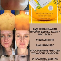 Фотография "ДЕТОКС для похудения - хороший вариант, для тех,кому хочется "перезагрузить" организм,избавив его от шлаков и токсинов, замедляющих обмен веществ.Ведь из-за медленного метаболизма лишние килограммы накапливаются👆"