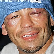 Фотография от arturo gatti