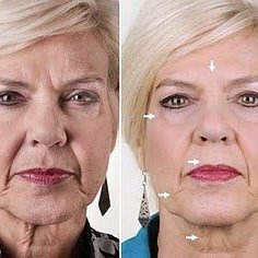 Фотография "Дистрибьютор Nu Skin, 73 года, из США. Активно использует весь спектр продукции Nu Skin"