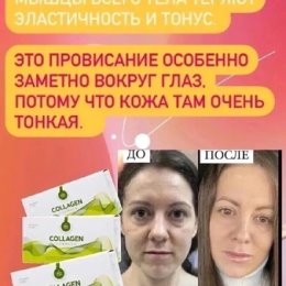 Фотография "💚Хочешь блестящие волосы❓
💚Кожу без морщин❓
💚Крепкие ногти❓
💚Не хрустящие 😁суставы❓
Тебе нужен ОН
Наш КОЛЛАГЕН ‼️‼️‼️"