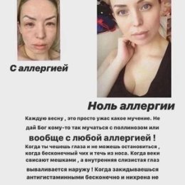 Фотография "
БИОДРОН  ОТЛИЧНО ПОМОГАЕТ 👇

Укрепить иммунитет 
Защитить организм от вирусов
Избавить от аллергии
Быстрому заживлению ран
Улучшает устойчивость организма к стрессам и физическим нагрузкам
Замедляет процесс старения "