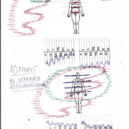 Фотография "Диаграмма моей ауры и 12 энергетических каналов до и после 10 мин на иглах иппликатора Кузнецова."