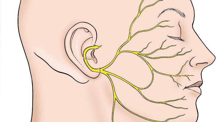 Неврит лицевого нерва видео. Неврит нижнечелюстного нерва. Неврит лицевого нерва анатомия. Ганглионит узла коленца лицевого нерва.