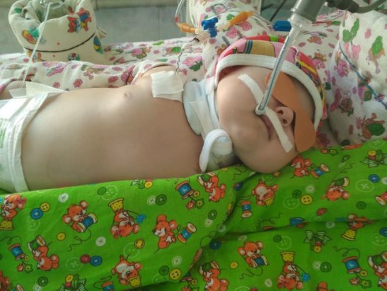 Дети с пороком сердца фото Дети с пороком сердца фото