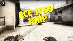 ACE (1 VS 5) AK-47 and MP7 18hp