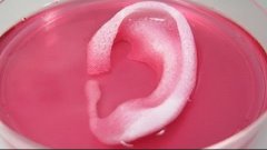 3-D printing could one day help fix damaged cartilage in kne...