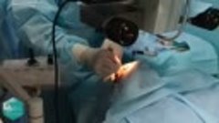 Одна из тысяч операций коррекции зрения в Госпитале Исманкул...