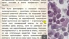 Увы, такова горькая правда - нас едят грибы.