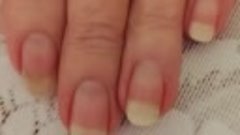Как удалось сохранить такие ногти? 😨
