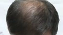 Чудесное средство Загуститель волос