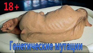 САМЫЕ СТРАШНЫЕ ГЕНЕТИЧЕСКИЕ МУТАЦИИ ☻ ИНТЕРЕСНЫЕ ФАКТЫ