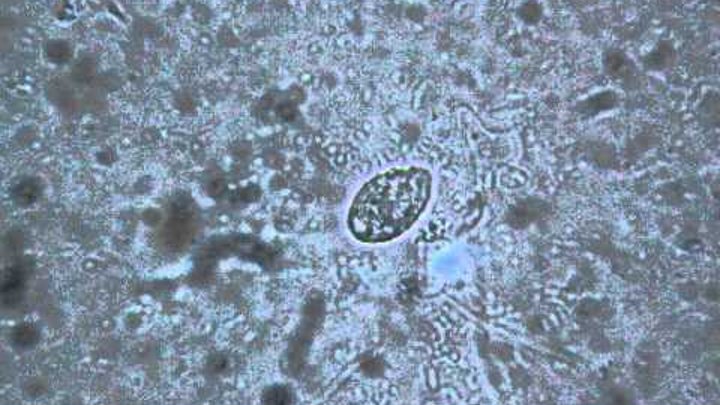 Бактерии в соленой воде. Микроскоп 200 крат. Кипяченая вода под микроскопом. Капля Речной воды под микроскопом. Морская вода под микроскопом.