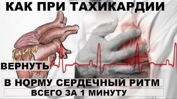 КАК ПРИ ТАХИКАРДИИ ВЕРНУТЬ В НОРМУ СЕРДЕЧНЫЙ РИТМ ВСЕГО ЗА ! МИНУТУ