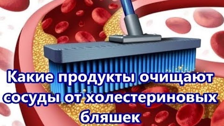 Чем чистить холестериновые бляшки