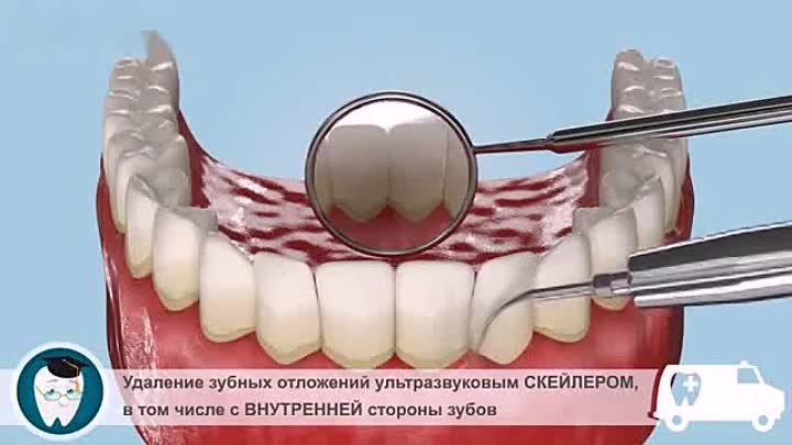 Чистка зубов ультразвуком и AirFlow