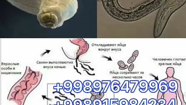 Gijjalarga qarwi vosita keldi.998976479969. 998915984234