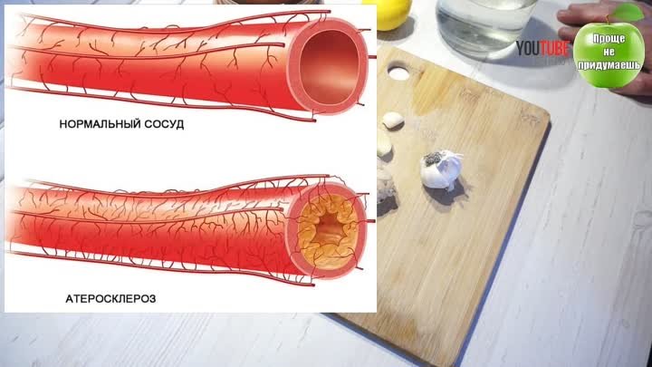 Старинный рецепт для расчистки Ваших артерий. Улучшаем кровоснабжени ...
