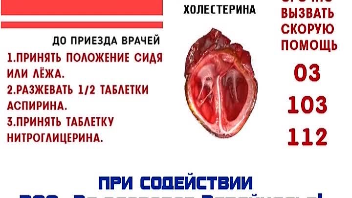 Здоровое Забайкалье_инфаркт