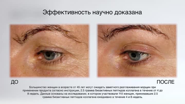 Лаура Чакон-Гарбато о Collagen Beauty Complex