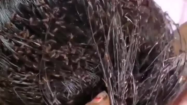 Жуки в волосах