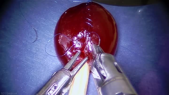 Робот-хирург «Да Винчи» зашивает виноградинку