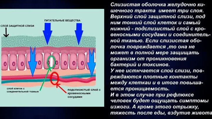 Почему возникает изжога  и что делать чтобы ее не было