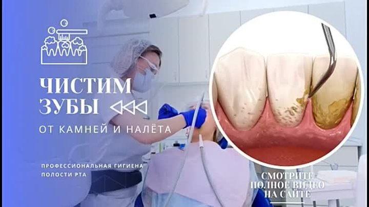 Профессиональная гигиена