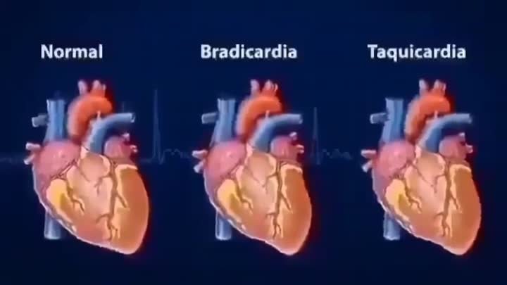 нормальный и патологический ритм