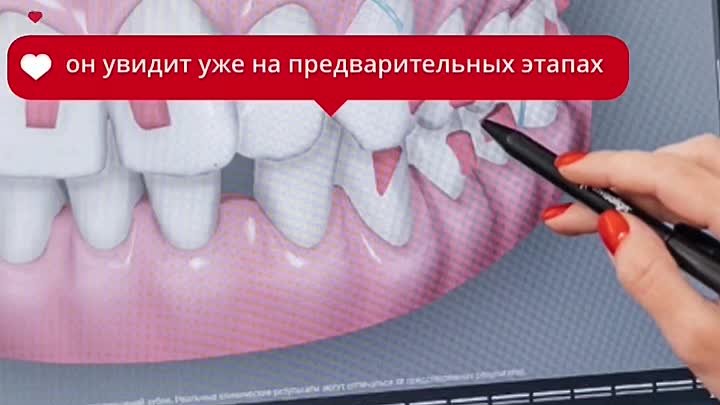 Цифровая зуботехническая лаборатория клиники Стоматика