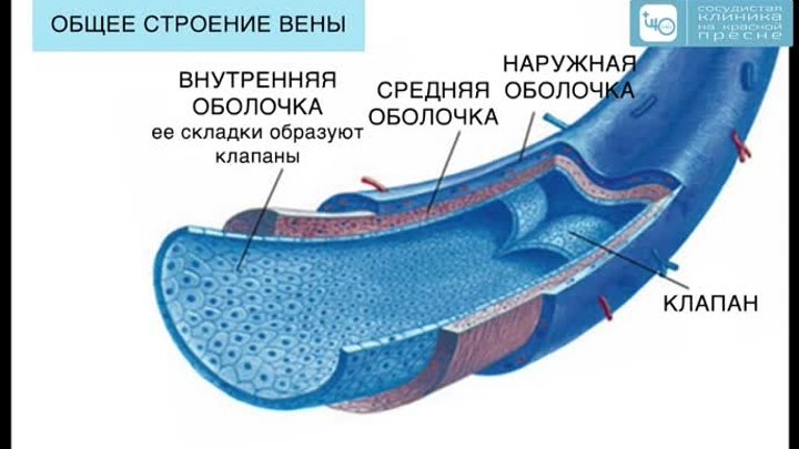 Доступно о варикозе