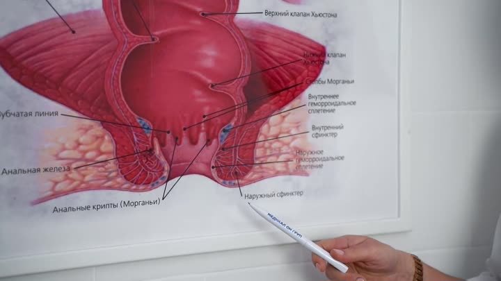 Проктолог ЕГ Христолюбова_ _Самая большая радость - видеть выздорове ...