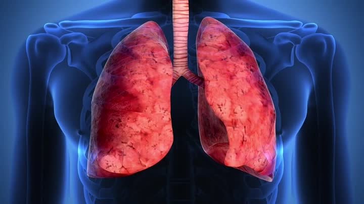 АСТМА - НЕ ПРИГОВОР | Причины и лечение бронхиальной астмы