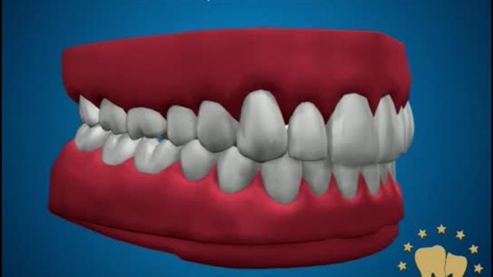 Ортопедическая стоматология - Протезирование полным съемным протезом ...