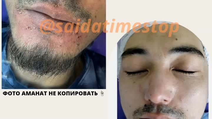 Приём по записи +7903 132 05 82. 