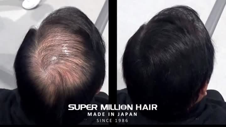 Super Million Hair - лучшее средство для маскировки редких волос!